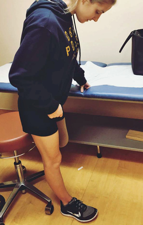 dreamputees: phelddagrif: Marine Kirstie Ennis who had her damaged left leg amputated below the knee