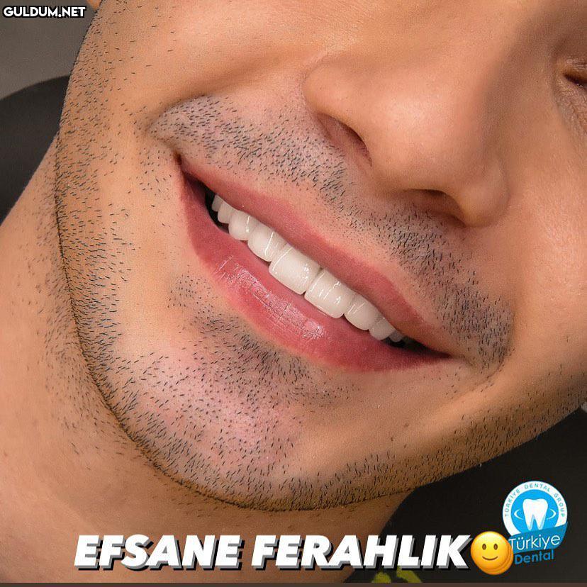 @turkeydental 👈...