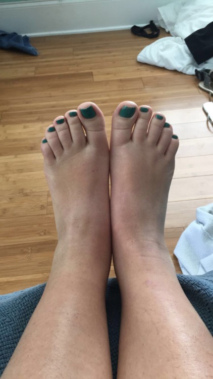 sexy-bare-feet: Here’s a few close ups from when I had green toes!!