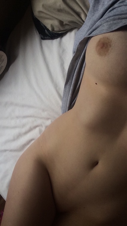 noctei: freckles