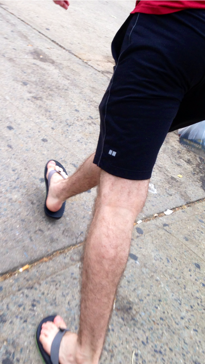 Hairy legs and hairy boys