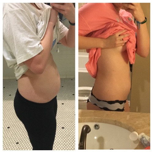 fitness-fits-me:  ergetsfit101 submitted:realllly starting to see results at the beginning of week three! crying at seeing my hips shrink 😭 not nearly done but I can’t thank you enough already!HOLY SHIZ this is AMAZING WOW!!! 😍 No problem at
