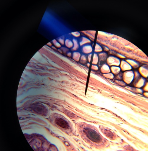 nayx:  cuntchita:  tristeprincesse:  Body Comparitive- Human Cartilage Tissue vs. Jupiter  bruuuuh   we are stardust  (: