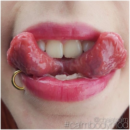 chaiatcalm: Healed #tonguesplit on @ralltuut that I performed at @calmbodymodification a couple of w