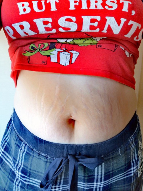 saffelinastuffs:I don’t know who needs to hear this, but stretchmarks don’t make your tummy any less cute! And anyone who makes you feel bad about it has the emotional maturity of a blueberry scone. 