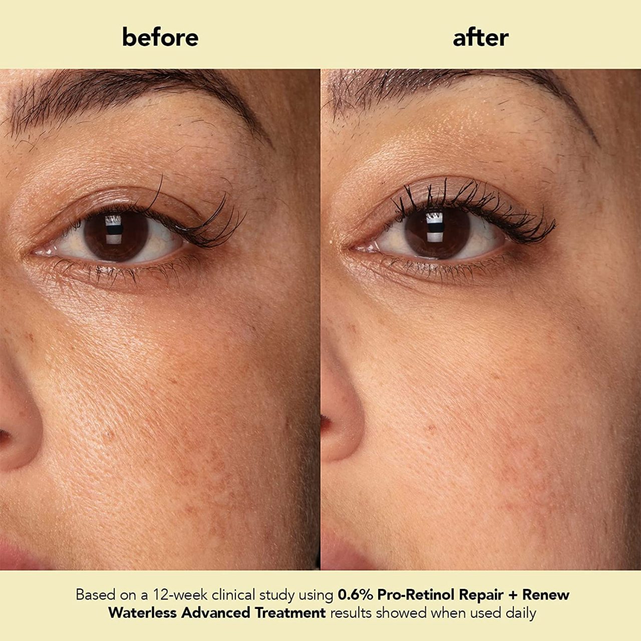 Stylish Belles — Before and After 12 weeks using Boscia Pro-Retinol...