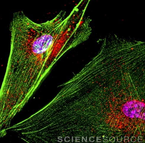 Brain Cell Transplants Are Being Tested Once Again For Parkinson&rsquo;sby Jon Hamilton / NPR He