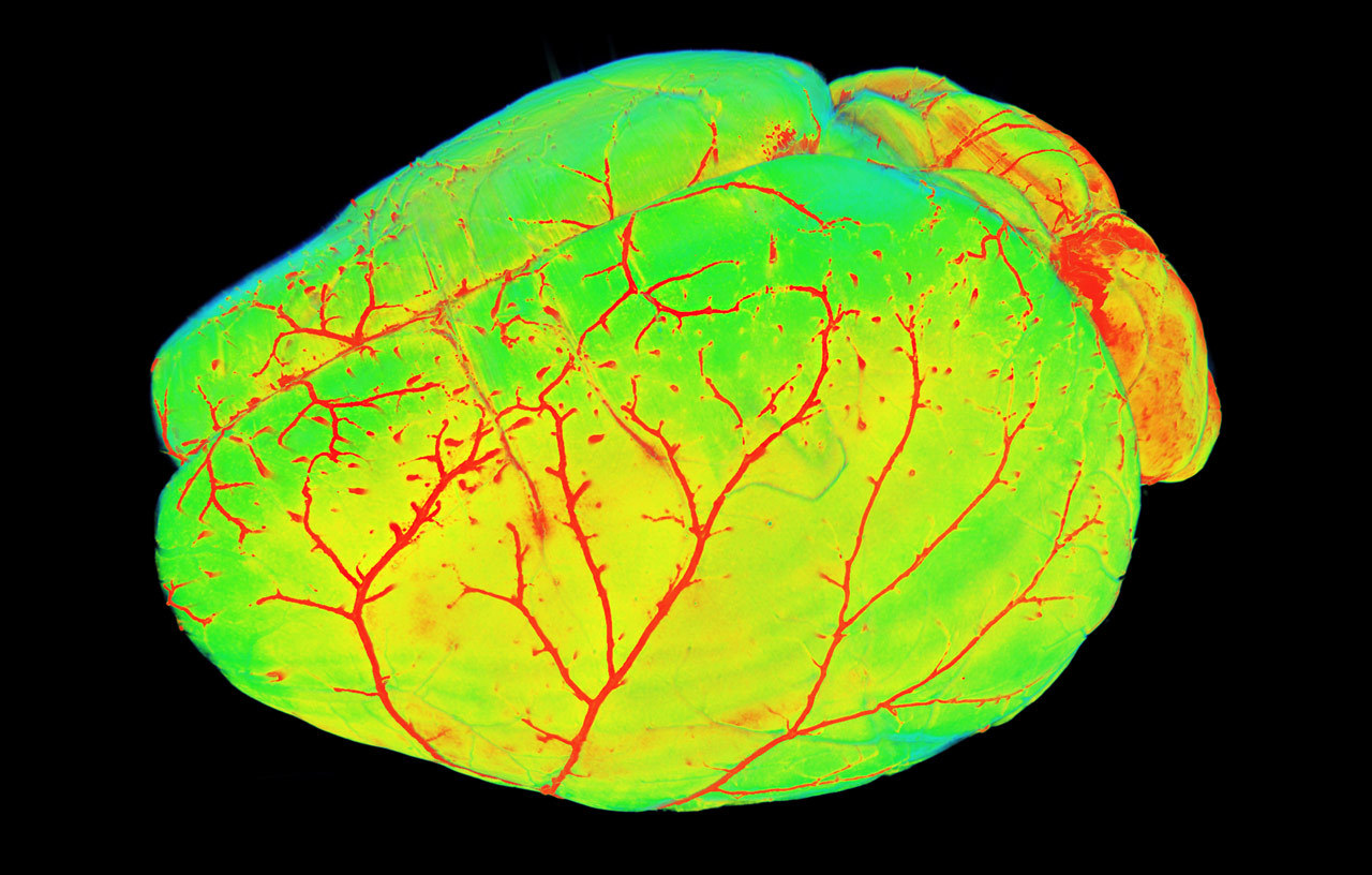 Mouse brain blood vessels
WHAT’S THAT?
Tissues need blood to live, and the brain is certainly no exception. But blood vessels are also an entry point for bad things like pathogens and toxins. Enter the blood-brain barrier: Like a bouncer, it allows...