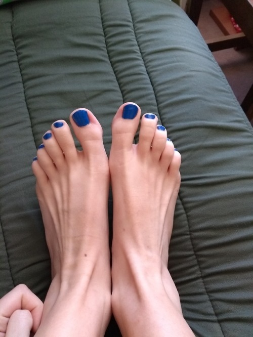 75poison-feet: so team Paint Your Nails won this time someone told me people with issues like blue 