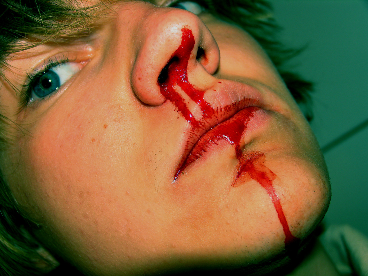 aphexangel:  fucktonofanatomyreferences:  An appeasing fuck-ton of wound references.