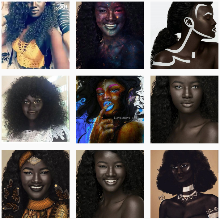 Teen Bullied For Complexion Is Now A Model And Instagram Sensation