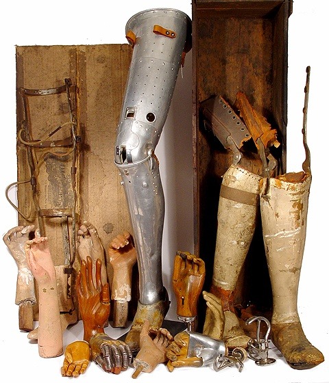 glitterandghouls:  Prosthetics from the 1800s to the 1930s