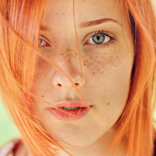 babes-with-freckles:Orange frex babes-with-freckles.tumblr.com/freckles Klasse Sommersprosse