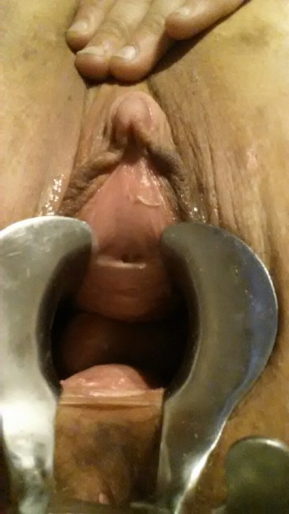 gynoftm:  As per request of @slvmaster4u, I present you with my vagina humiliatingly stretched open for full observation of my cervix.   nice ‘n’ wide