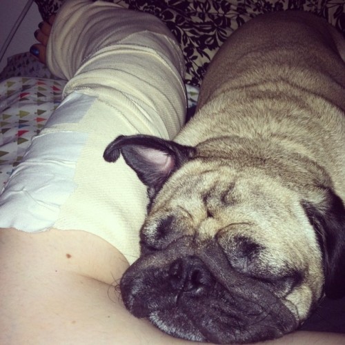 Healing pug stone treatment for my broken leg #broken #ouch #puglove #puglife