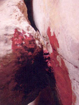marianilima:  Photos taken by Aron Ralston, before and after he had to cut off his arm. 