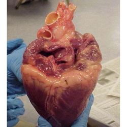 medicinethings:  Heart/Corazón 