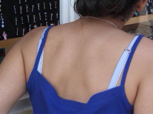 hairy back