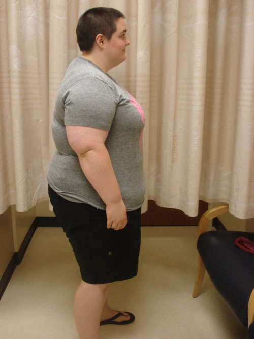 fitchris25:  strongerfasterlover:  Yesterday I went to my 1 year post op appointment. They took updated pictures of me and sent them to me this morning. I’m pretty pleased with the obvious changes to my body. My head shots are fucking horrible. But
