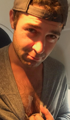 mynewplaidpants:  James Wolk got a Breathe-Right