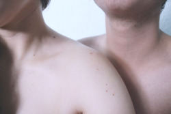 teenagelobatomy:  skin by Juan Pablo Tavera