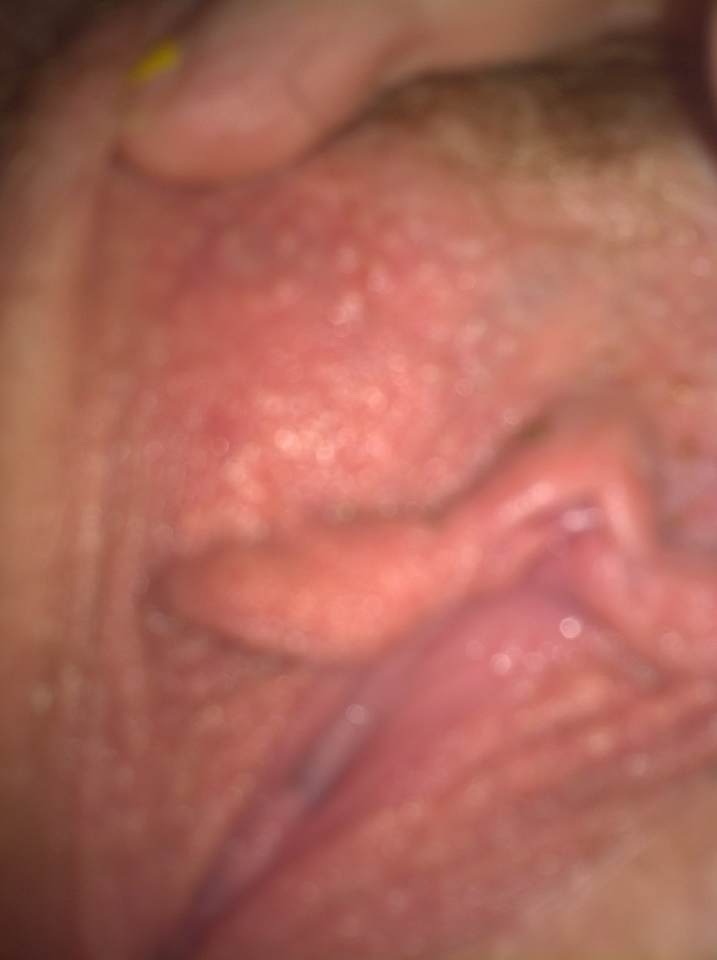 anonnudesblog:  Blurry, but pussy is pussy ;)