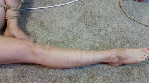 Last Sunday, Radical Girl came over and I practiced rope on her. These are the marks left behind aft