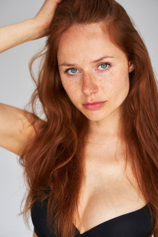 frecklesarebrilliant:  Freckles are brilliant