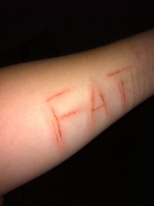 my-per-sonal:  damages of last night,i hate myself so much i don’t even know why im posting all of this here. im nothing. there is maybe 3 people that probably would care if i kill myself. but is this enough to keep me here ? i don’t think so.