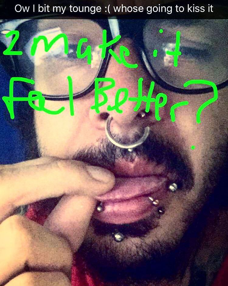 #bitmytongue #kissitsoitcanfeelbetter
