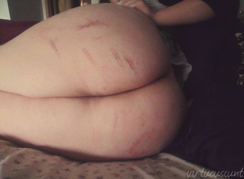 sadisticcreature: virtuouscunt: more photos bc I love my butt more when it has ouchies!! You’r
