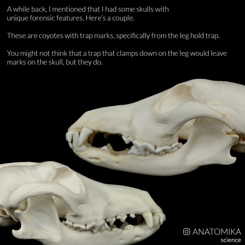 Some skulls with interesting forensic features