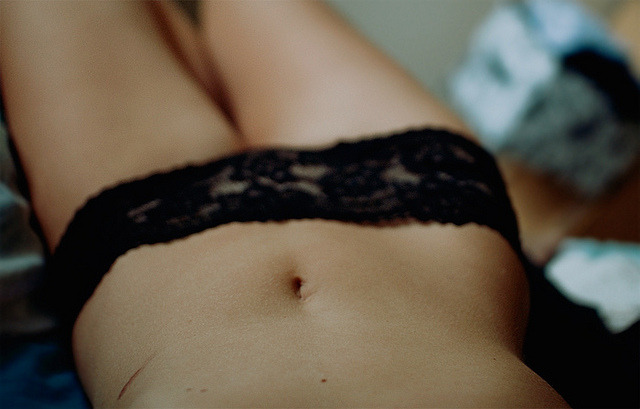 refleurs:  Scars by ardemonia . on Flickr. 