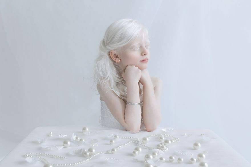 Albino Beauty Tumblr Posts Tumbral Com