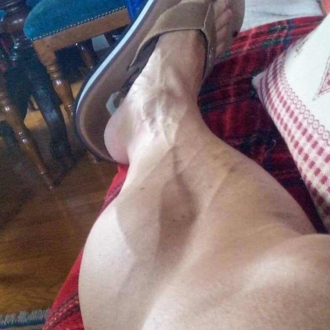 Andrea Pimazzoni