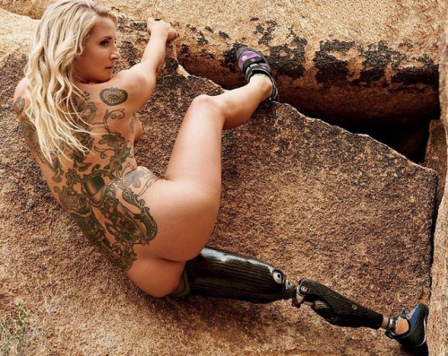 Marine who lost her leg below knee.  Then had an infection and they had to go above kneeCredit to ES