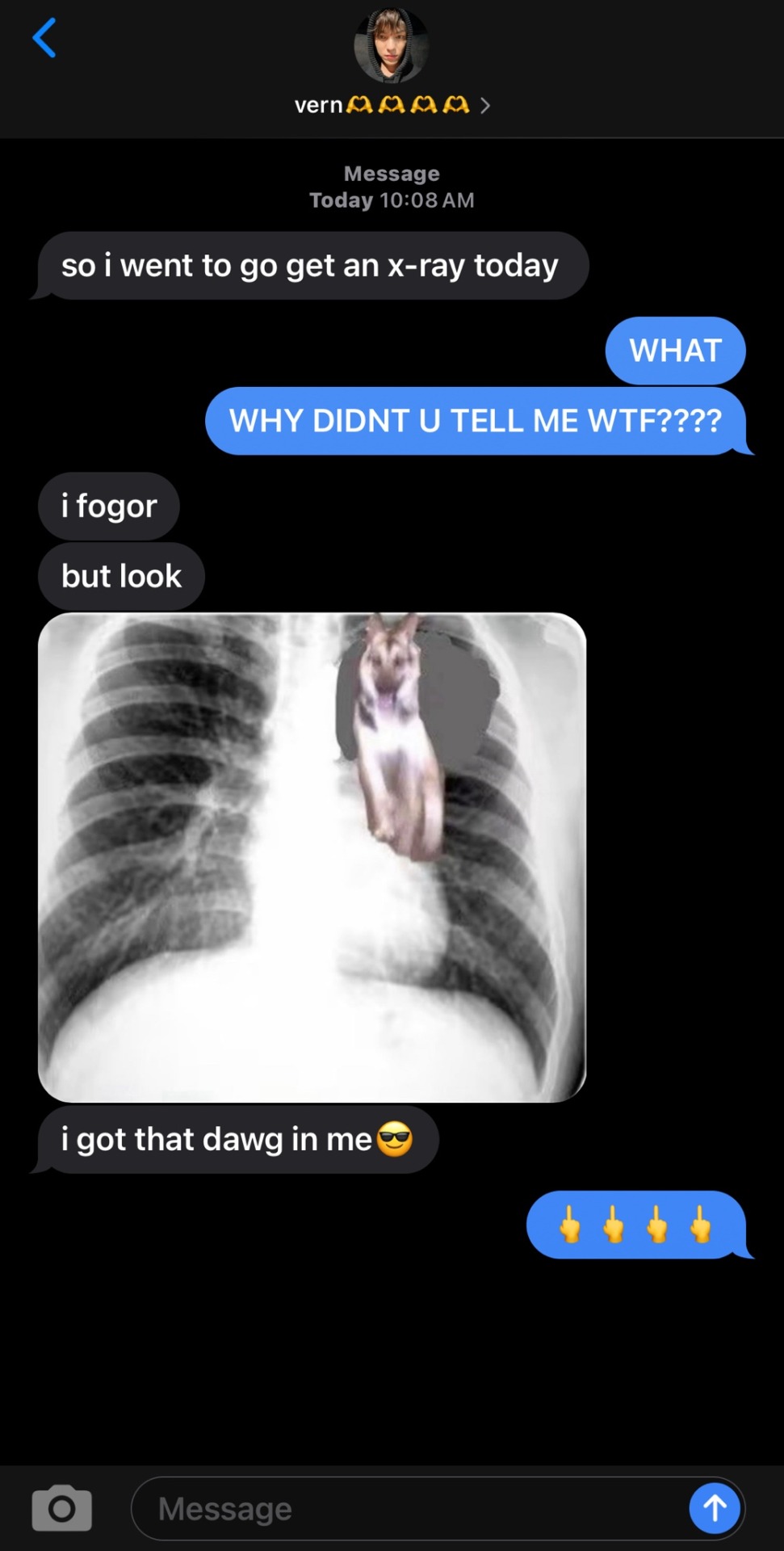 BONON BF TEXTS PLSSSSSS