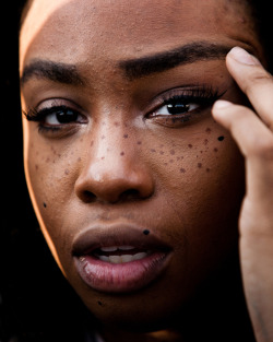 voguememoirs:  her freckles are placed like