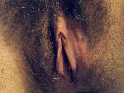 Sex Hirsute pictures