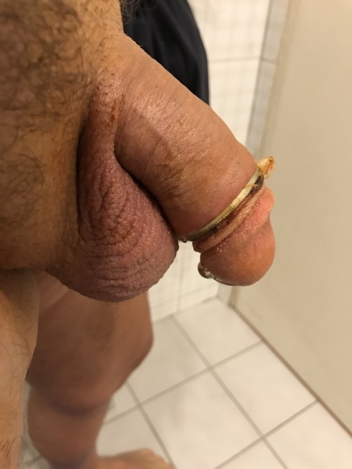 swamigay:  Day 5 officially circumcised Eeeehhhhhhhh LOL :) Auto Circuncisión  Self Circumcision  