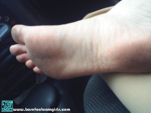 XXX jennsummers50:  Mandy is wearing a toe photo