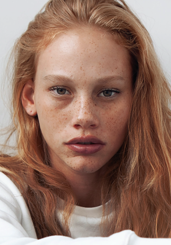 peppermintstranger:Tess Carter — born in 2002 — Bahamas Feine Sommersprossen