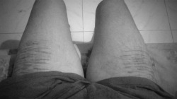 otrosuicidainsignificante:Las piernas de un hombre, tambien tienen historias que contar!