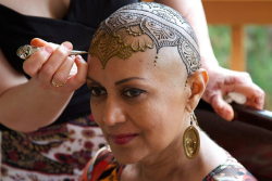 micdotcom:  Henna tattoos empower, heal women experiencing hair loss  In the struggle against cancer, alopecia and plain-old aging, hair loss can be a stressful side effect that weighs on a person’s self-confidence and can affect how he or she is treated