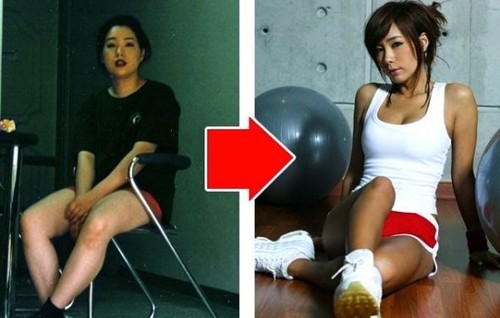 A 46 year old mother of two lost 20 kg in 3 months by exercising and dieting. Her