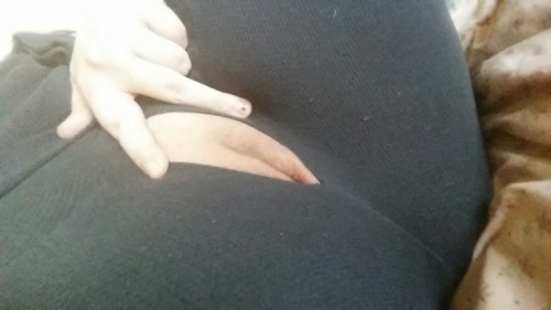 shyblondegirllll:  Oops my pants ripped