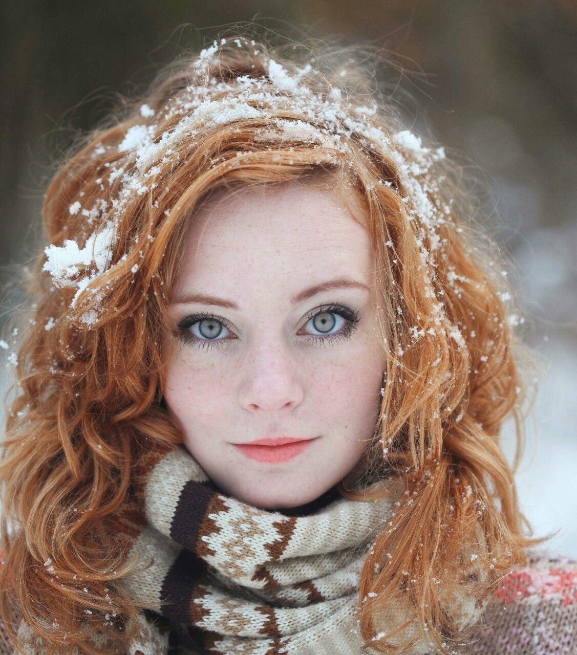 frecklesarebrilliant:Freckles are brilliant