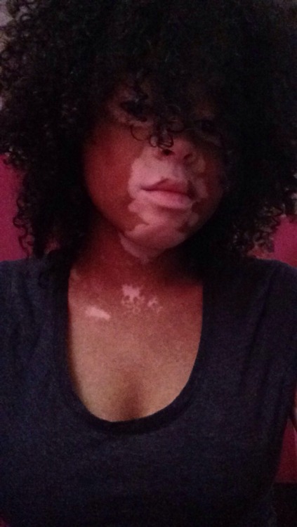 afatblackfairy:  kiirbsterr:  Look at my nose it’s cute  omfg cute cute cute