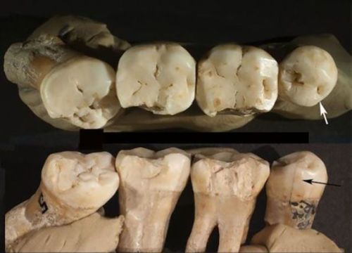 Neanderthal teeth found in Krapina (northern Croatia), from about130,000 years ago.This Neanderthal 