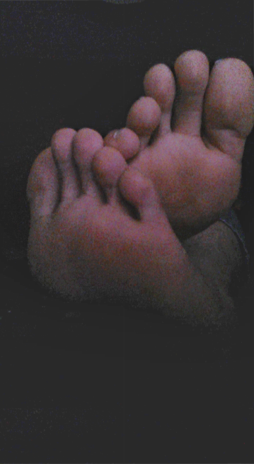 g-feet20:  An old set of photos I took with a webcam a while back. Sorry about the
